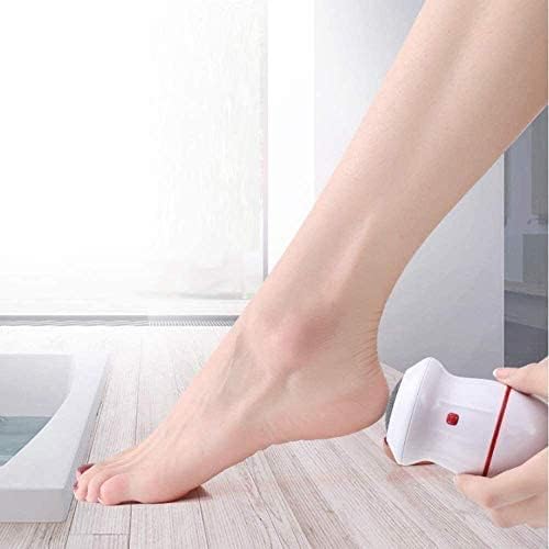 ELECTRIC FEET REMOVAL