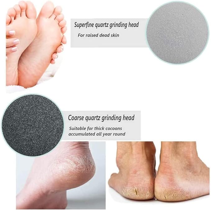 ELECTRIC FEET REMOVAL